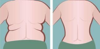 How to get rid of back fat in a week