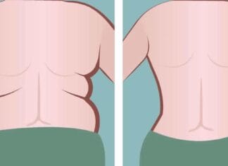 How to get rid of back fat in a week