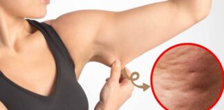6 Best Exercises To Get Rid Of Cellulite On Arms