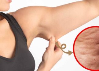 6 Best Exercises To Get Rid Of Cellulite On Arms