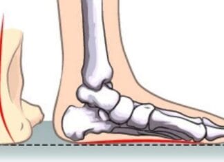 7 Effective High Arch Foot Exercises for Foot Pain Relief