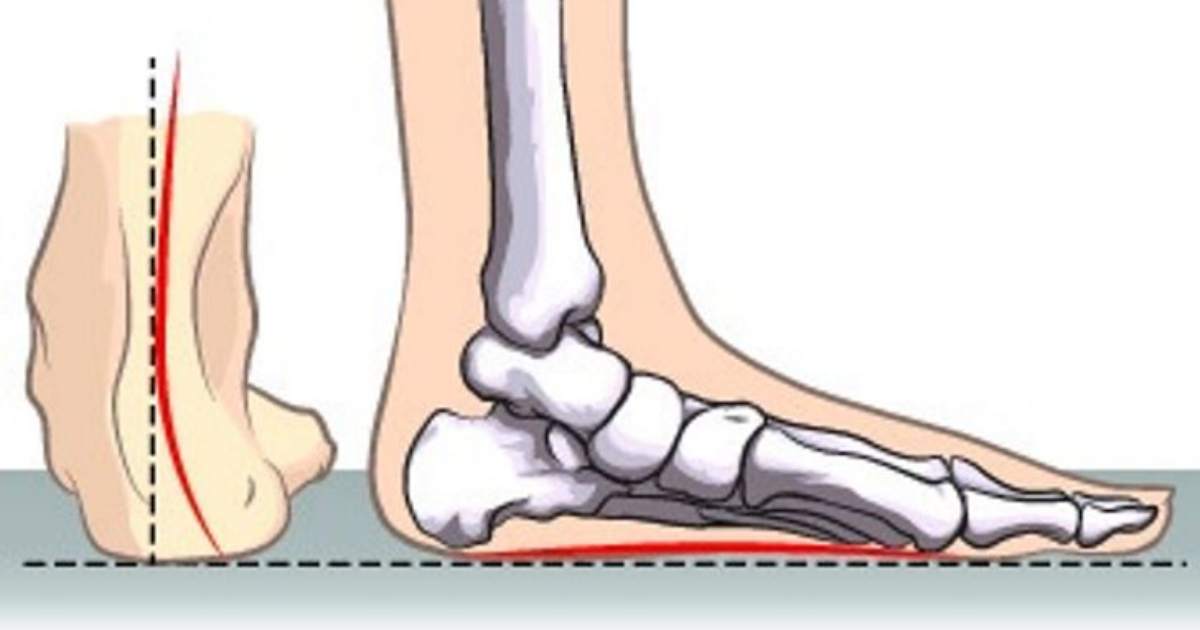 7 Exercises From Orthopedists To Increase Arch Height And Reduce Foot Pain1 