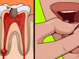 9 Incredible Home Remedies For Toothache Pain Relief