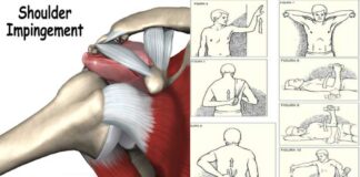 Top 5 Shoulder Impingement Exercises