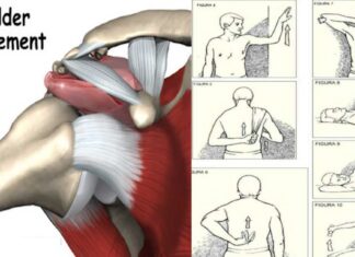 Top 5 Shoulder Impingement Exercises